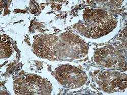 Immunohistochemistry (Formalin/PFA-fixed paraffin-embedded sections) - Anti-GFPT1 antibody (AB176775)