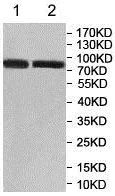 Western blot - Anti-GFPT1 antibody (AB176775)