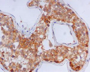 Immunohistochemistry (Formalin/PFA-fixed paraffin-embedded sections) - Anti-GFPT1 antibody [EPR4854] (AB125069)