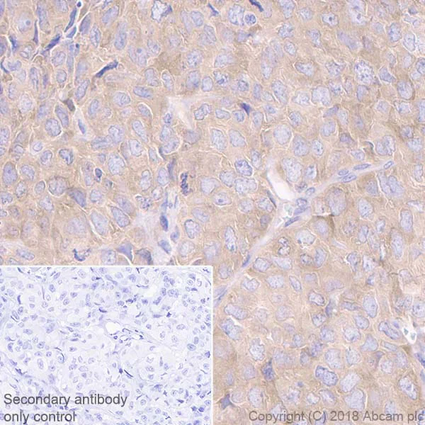 Immunohistochemistry (Formalin/PFA-fixed paraffin-embedded sections) - Anti-GFPT1 antibody [EPR4854] (AB125069)
