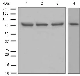 Western blot - Anti-GFPT1 antibody [EPR4854] (AB125069)