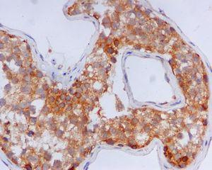Immunohistochemistry (Formalin/PFA-fixed paraffin-embedded sections) - Anti-GFPT1 antibody [EPR4854] - BSA and Azide free (AB236053)