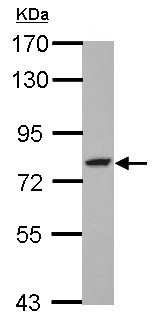 Western blot - Anti-GFPT2 antibody (AB155926), expandable thumbnail