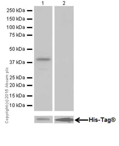 Western blot - Anti-GFPT2 antibody [EPR19095] (AB190966)