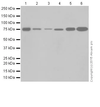 Western blot - Anti-GFPT2 antibody [EPR19095] (AB190966)