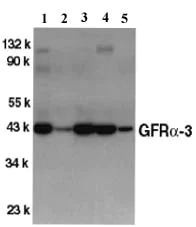 Western blot - Anti-GFR alpha 3/GFRA3 antibody (AB8028)