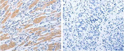 Immunohistochemistry (Formalin/PFA-fixed paraffin-embedded sections) - Anti-GFRA4 antibody (AB183077)