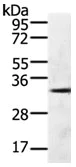 Western blot - Anti-GFRA4 antibody (AB183077)