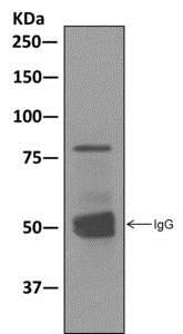 Immunoprecipitation - Anti-GGA1 antibody [EPR3014(2)] (AB170956), expandable thumbnail