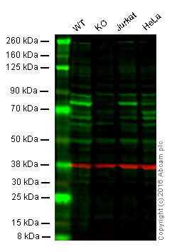 Western blot - Anti-GGA1 antibody [EPR3014(2)] (AB170956), expandable thumbnail