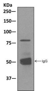 Immunoprecipitation - Anti-GGA1 antibody [EPR3014(2)] - BSA and Azide free (AB249621)