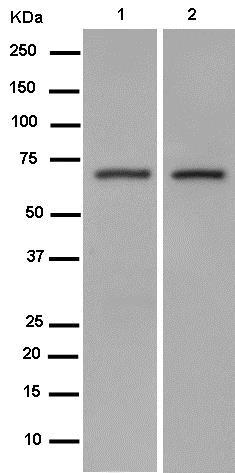 Western blot - Anti-GGA2 antibody [EPR14895] (AB185557)