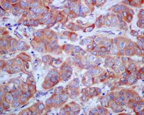 Immunohistochemistry (Formalin/PFA-fixed paraffin-embedded sections) - Anti-GGA3 antibody [EPR14340] (AB180951)