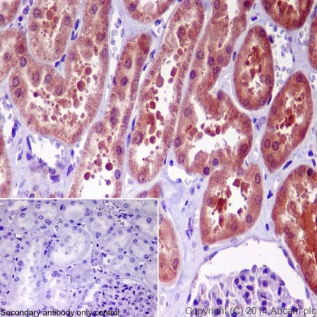 Immunohistochemistry (Formalin/PFA-fixed paraffin-embedded sections) - Anti-GGCT antibody [EPR17107] - BSA and Azide free (AB251258), expandable thumbnail