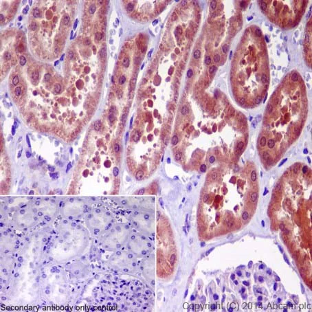 Immunohistochemistry (Formalin/PFA-fixed paraffin-embedded sections) - Anti-GGCT antibody [EPR17107] - BSA and Azide free (AB251258)