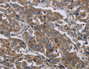 Immunohistochemistry (Formalin/PFA-fixed paraffin-embedded sections) - Anti-GGCX antibody (AB197982)