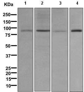 Western blot - Anti-GGCX antibody [EPR11632] (AB170921), expandable thumbnail