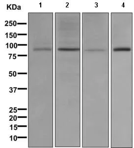 Western blot - Anti-GGCX antibody [EPR11632] (AB170921)