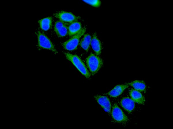 Immunocytochemistry/ Immunofluorescence - Anti-GGCX antibody [EPR11632] - BSA and Azide free (AB249592)