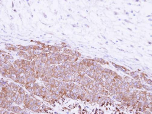 Immunohistochemistry (Formalin/PFA-fixed paraffin-embedded sections) - Anti-GGH antibody (AB272875), expandable thumbnail