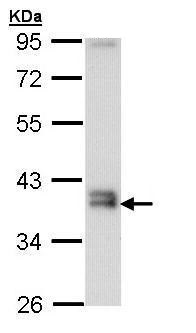 Western blot - Anti-GGH antibody (AB272875), expandable thumbnail