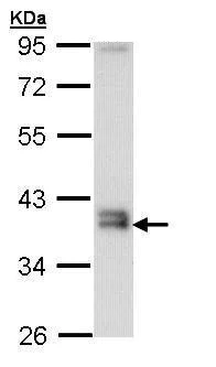 Western blot - Anti-GGH antibody (AB272875)