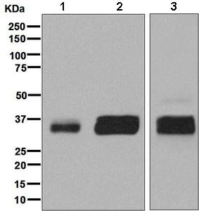 Western blot - Anti-GGH antibody [EPR8014] (AB138495), expandable thumbnail