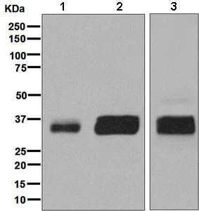 Western blot - Anti-GGH antibody [EPR8014] (AB138495)