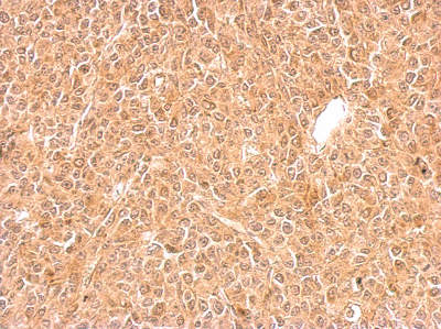 Immunohistochemistry (Formalin/PFA-fixed paraffin-embedded sections) - Anti-GGPS1 antibody (AB155584)