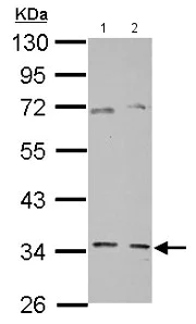 Western blot - Anti-GGPS1 antibody (AB155584)
