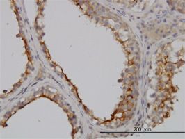 Immunohistochemistry (Formalin/PFA-fixed paraffin-embedded sections) - Anti-GGT1/GGT antibody [1F9] (AB55138), expandable thumbnail