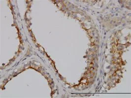 Immunohistochemistry (Formalin/PFA-fixed paraffin-embedded sections) - Anti-GGT1/GGT antibody [1F9] (AB55138)