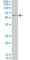Western blot - Anti-GGT1/GGT antibody [1F9] (AB55138), expandable thumbnail