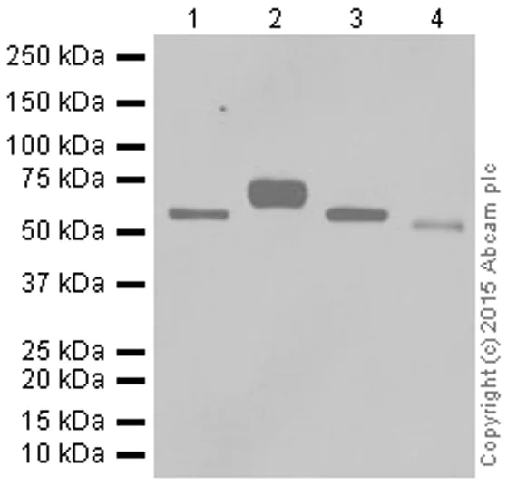 Western blot - Anti-GGT1/GGT antibody [EPR5288] (AB109427)