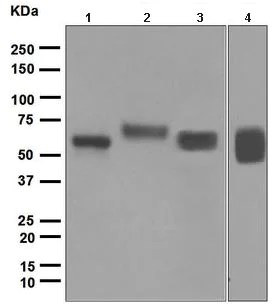 Western blot - Anti-GGT1/GGT antibody [EPR5288] (AB109427)