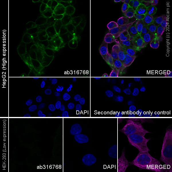 Immunocytochemistry/ Immunofluorescence - Anti-GGT1/GGT + GGT3 antibody [EPR28715-82] - BSA and Azide free (AB316769)