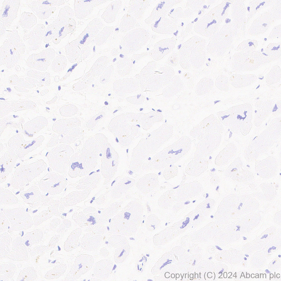 Immunohistochemistry (Formalin/PFA-fixed paraffin-embedded sections) - Anti-GGT1/GGT + GGT3 antibody [EPR28715-82] - BSA and Azide free (ab316769), expandable thumbnail