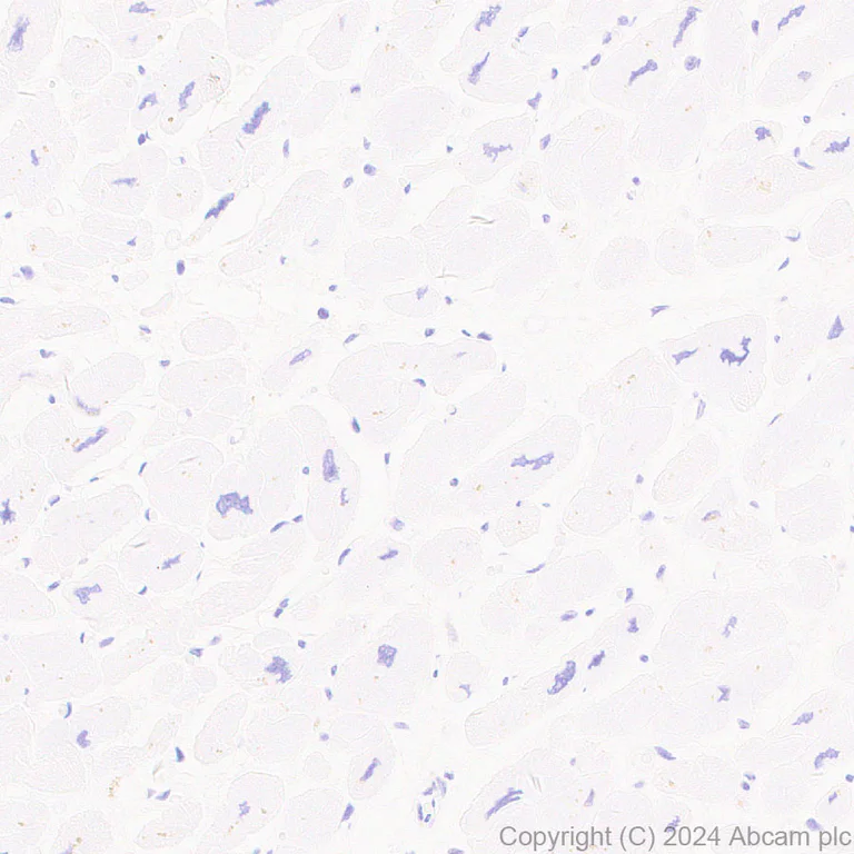 Immunohistochemistry (Formalin/PFA-fixed paraffin-embedded sections) - Anti-GGT1/GGT + GGT3 antibody [EPR28715-82] - BSA and Azide free (AB316769)