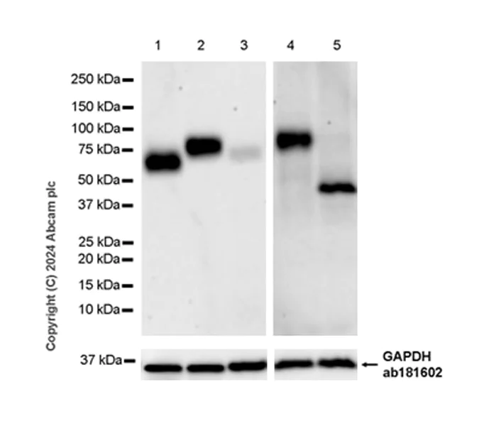 Western blot - Anti-GGT1/GGT + GGT3 antibody [EPR28715-82] - BSA and Azide free (AB316769)