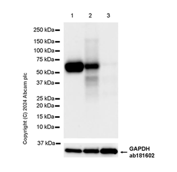 Western blot - Anti-GGT1/GGT + GGT3 antibody [EPR28715-82] - BSA and Azide free (AB316769)
