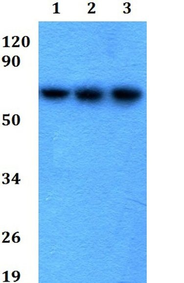 Western blot - Anti-GGT5 antibody (AB200647), expandable thumbnail