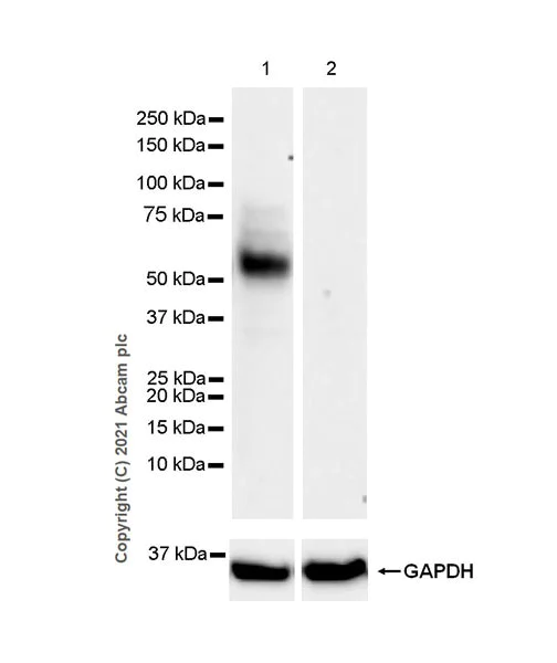 Western blot - Anti-GGT5 antibody [EPR24682-102] - BSA and Azide free (AB283290)