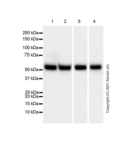 Western blot - Anti-GGT5 antibody [EPR24682-102] - BSA and Azide free (AB283290)