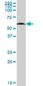 Western blot - Anti-GGT6 antibody (AB70516)