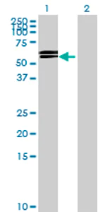 Western blot - Anti-GGT6 antibody (AB70516)