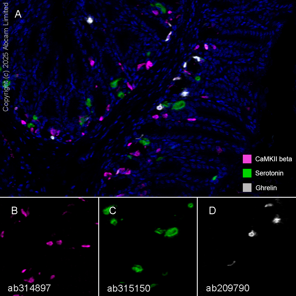 Multiplex immunohistochemistry - Anti-Ghrelin antibody [EPR20502] (AB209790)