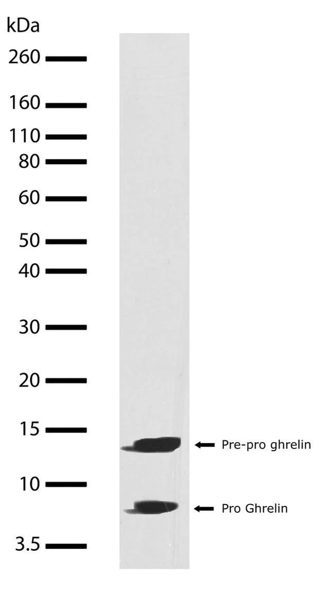 Western blot - Anti-Ghrelin antibody [RP23040062] (AB308017)