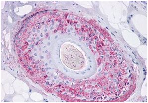 Immunohistochemistry (Formalin/PFA-fixed paraffin-embedded sections) - Anti-Ghrelin Receptor/GHS-R antibody (AB188986), expandable thumbnail