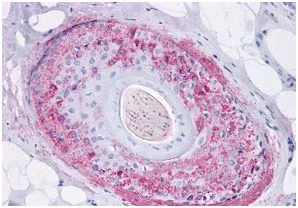 Immunohistochemistry (Formalin/PFA-fixed paraffin-embedded sections) - Anti-Ghrelin Receptor/GHS-R antibody (AB188986)