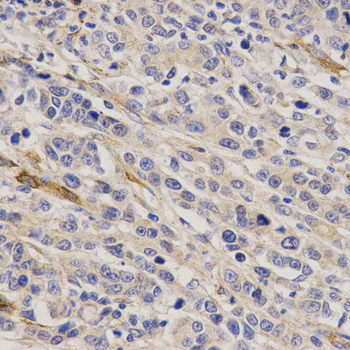 Immunohistochemistry (Formalin/PFA-fixed paraffin-embedded sections) - Anti-GHRH antibody (AB187512)